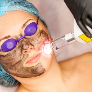 abnikka-hollywood-carbon-peeling-laser-art-by-nikka