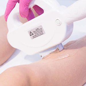 abnikka-shr-permanent-hårfjerning-laser-fjernelse-hår-top-lite-art-by-nikka